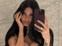 "Otkazivali su mi organi i pluća, jedva sam preživela": Poznata Srpkinja o nesreći koja joj je promenila život 