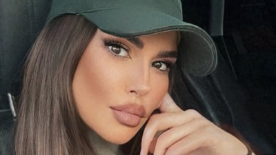 Oglasila se Dijana Dilajn nakon operacije vilice: "Tri i po sata je trajala intervencija"