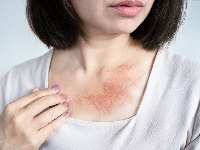 OVE promene na koži mogu da ukažu na OPASNE KARDIOVASKULARNE PROBLEME 