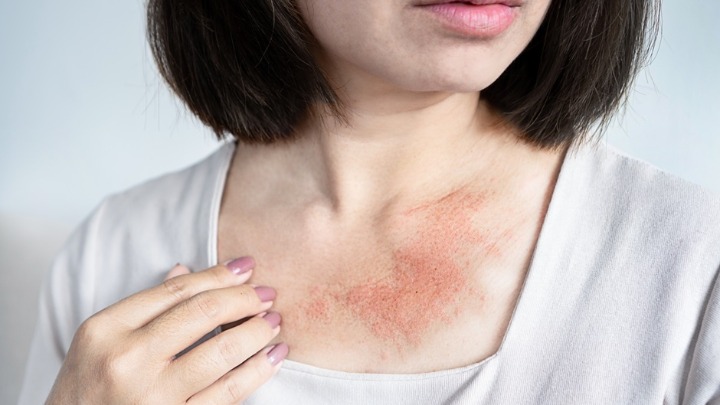 OVE promene na koži mogu da ukažu na OPASNE KARDIOVASKULARNE PROBLEME 