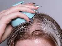 Jedan sastojak iz kuhinje daje neverovatan efekat i čini kosu gušćom - SVI ga IMAMO 