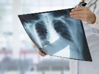 Šta je obostrana upala pluća? Obratite pažnju - ovo su rani simptomi teške pneumonije 