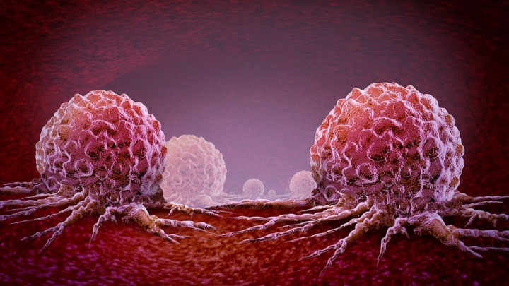 Stručnjaci tvrde: Ove DVE NAVIKE su glavni KRIVCI za većinu KARCINOMA koji se mogu sprečiti