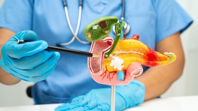 Naučnici otkrili RANI SIMPTOM jednog od NAJAGRESIVNIJIH VRSTA RAKA: Javlja se godinama pre prvih znakova 