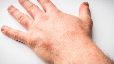 Proizvođač: Naš sapun nije uzrok problema koji su prijavili roditelji dece u vrtićima u Beogradu