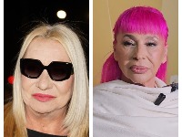 "Mnogo mi je žao": Vesna Zmijanac o zdravstvenom stanju Zorice Brunclik 