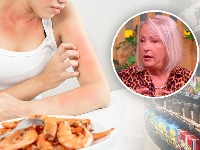 Nutricionistkinja Milka Raičević za DIREKTNO upozorava: Jedna zdrava namirnica može pogoršati simptome alergije