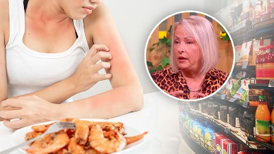 Nutricionistkinja Milka Raičević za DIREKTNO upozorava: Jedna zdrava namirnica može pogoršati simptome alergije