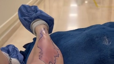 Otrovni pauk prekinuo turneju: Pevačica završila u bolnici, ali poručila: "Šou mora da se nastavi“