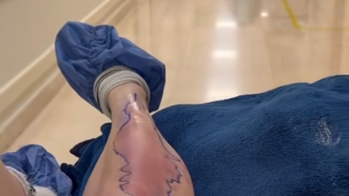 Otrovni pauk prekinuo turneju: Pevačica završila u bolnici, ali poručila: "Šou mora da se nastavi“