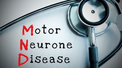 Bolest motornih neurona odnela glumca iz "Igre prestola": Ovo su prvi simptomi koje mnogi ignorišu