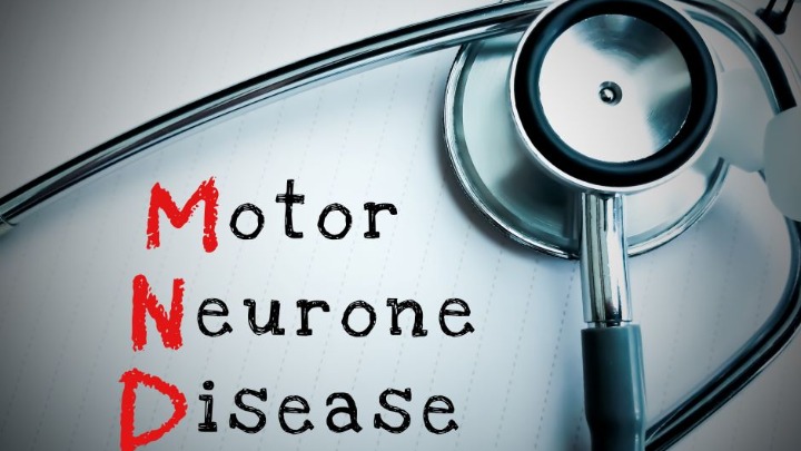 Bolest motornih neurona odnela glumca iz "Igre prestola": Ovo su prvi simptomi koje mnogi ignorišu