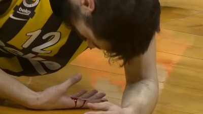 (FOTO) Kalinić pokazao slomljen nos, pa se našalio na svoj račun