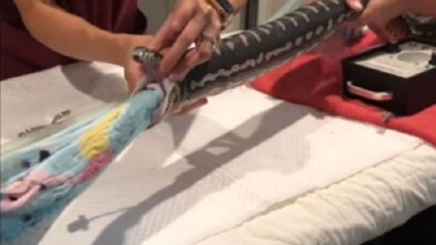 (VIDEO) Veterinari izvadili iz pitona peškir za plažu